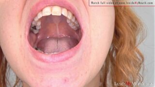 Dental fetish